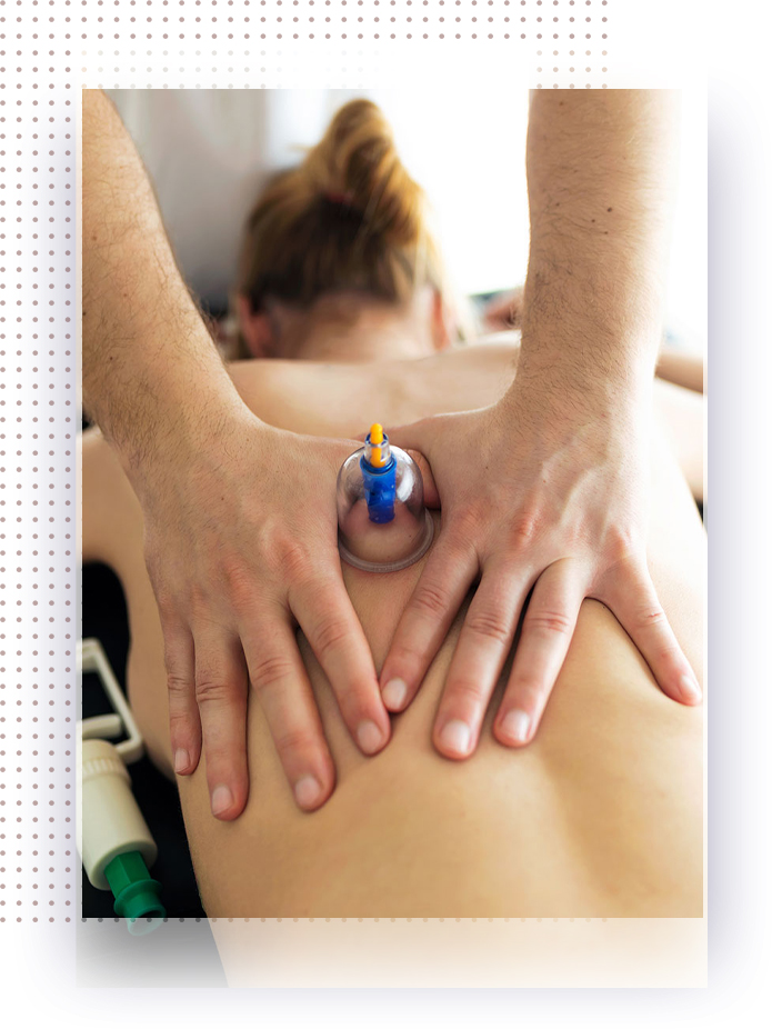 Cupping Therapy Near Me