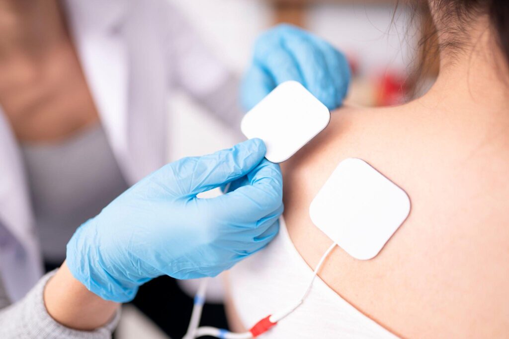functional electrical stimulation therapy
